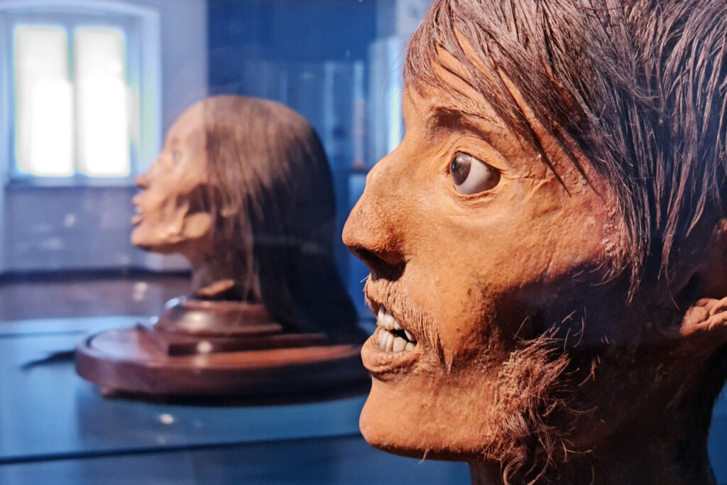 Fotografia di due teste pietrificate del Gabinetto anatomico di Salò